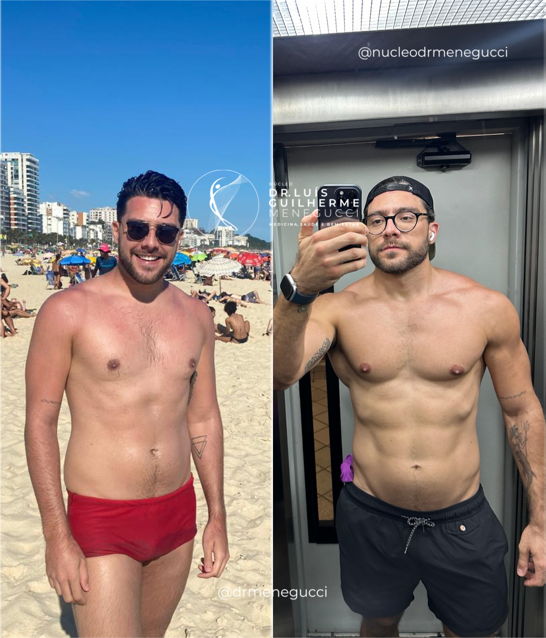 Resultado de emagrecimento