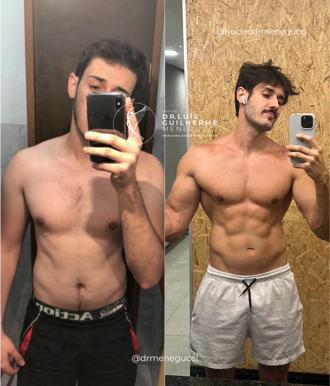 Resultado de definição corporal e estética